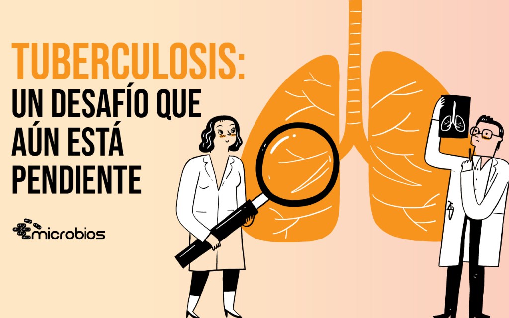 Tuberculosis: Un desafío que aún está&nbsp;pendiente